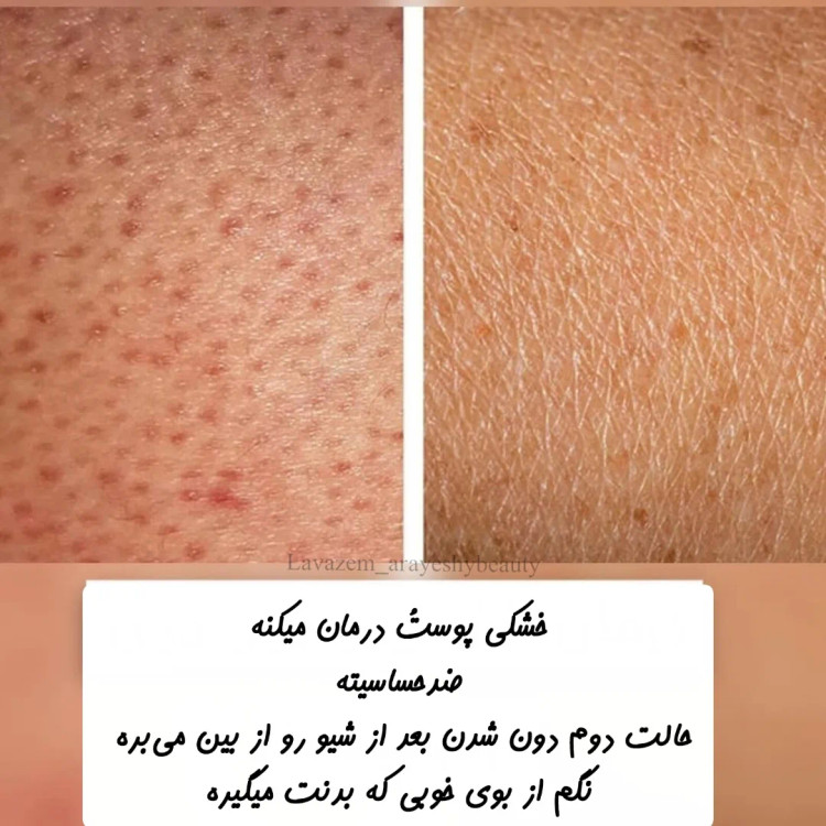 لوسیون روشن کننده و مرطوب کننده بدن شیرگاو