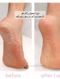 جوراب سیلیکونی اصلی جعبه دار (رفع ترک و خشکی پا)
