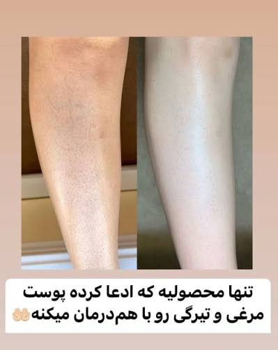 نمک بدن تیوپی هلو (لایه بردار) حجم ۲۵۰ گرمی 💯 اصلی 🍑