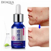 سرم ضدجوش اورژانسی 30 میل🌱