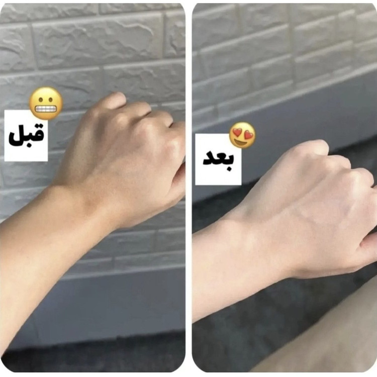 کرم سفید کننده فوری و طبیعی بدن 🧖🏻♀️🪞🧴
